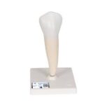 Primer molar inferior de raíz sencilla