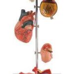 EFFECTS OF HYPERYTENSION