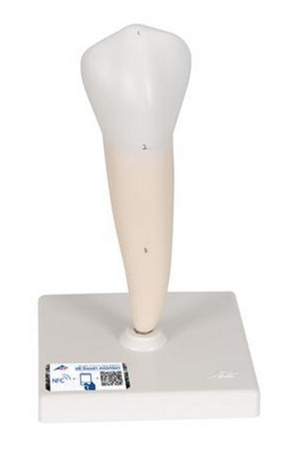 Primer molar inferior de raíz sencilla