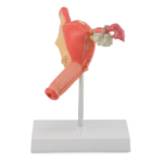 PATHOLOGICAL MODEL OF THE FEMALE REPRODUCTIVE SYSTEM