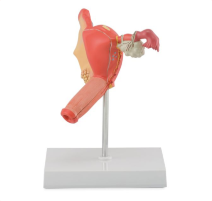 PATHOLOGICAL MODEL OF THE FEMALE REPRODUCTIVE SYSTEM
